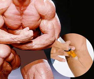 Find Out Now, What Should You Do For Fast steroids structure?